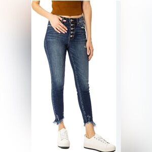 Classic Blue Ankle Jeans with Button Detail